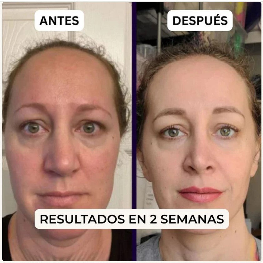 PuraDerma™