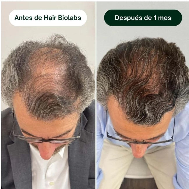 Sérum Anticaída de Doble Acción | Hair Biolabs™