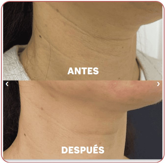Máscaras de Cuello Aurealface™