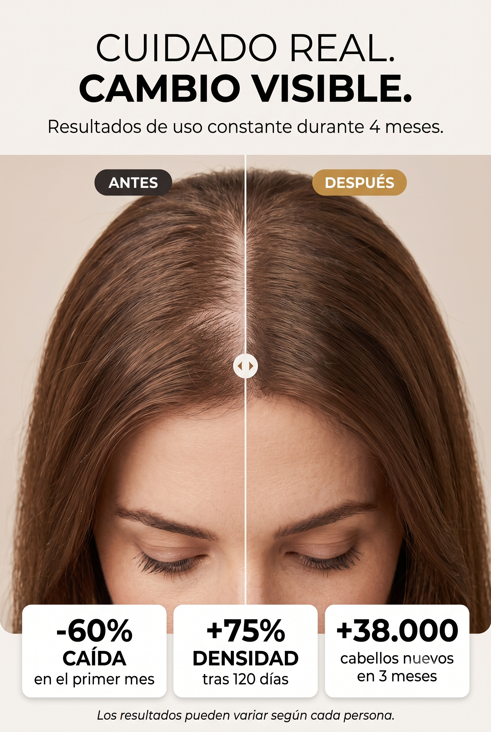 El Complejo Anti-DHT DENSA