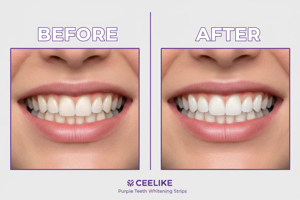 Whitening strips