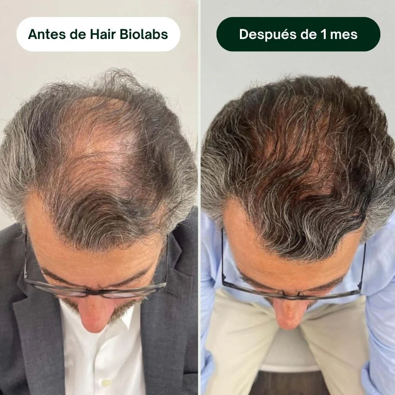 Sérum Anticaída de Doble Acción
