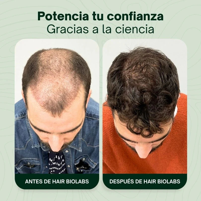 Sérum Anticaída de Doble Acción
